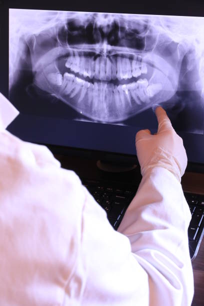 Best Emergency Dental Care for Abscessed Tooth in Stockdale, TX